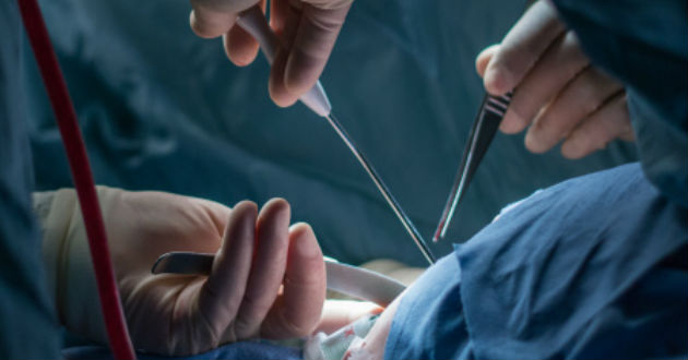 operacion-trasplante_635.jpg