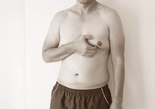 operaciones-esteticas-hombre.jpg
