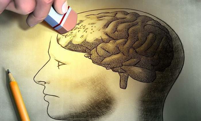 Alzheimer-istock-770.jpg