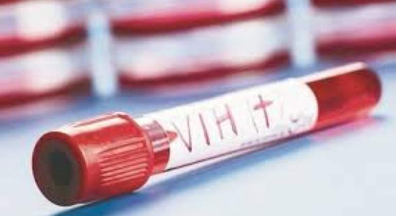 vih-contagios-jovenes.jpg