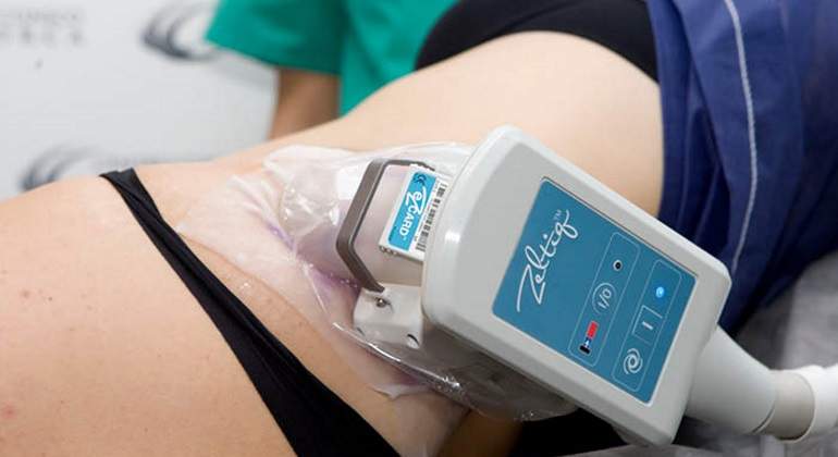 Criolipolisis-770.jpg