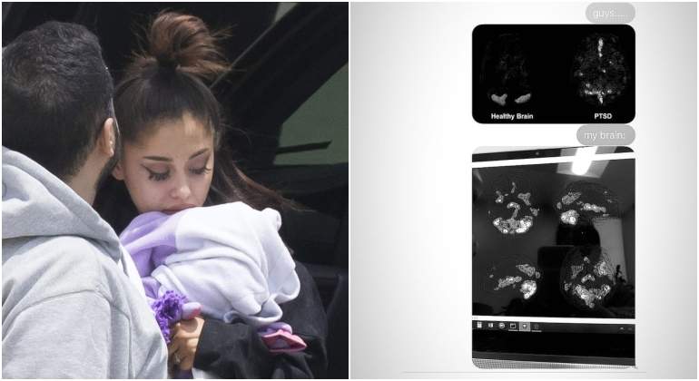 ariana-grande-estres-postraumatico.jpg
