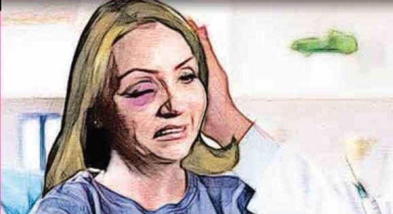 angelica-rivera-mandibula-accidente.jpg