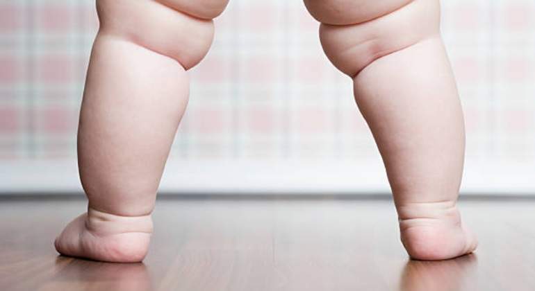 Obesidad infantil