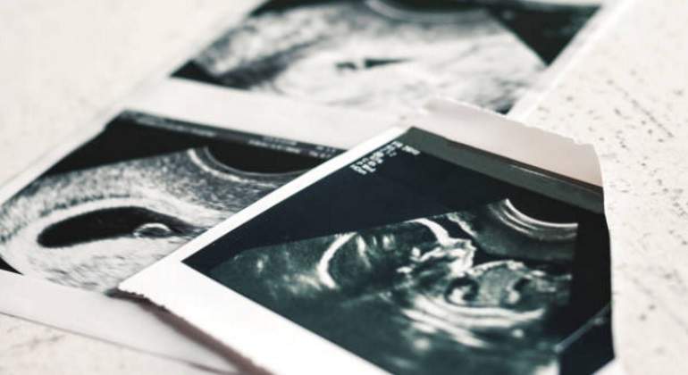 electrocardiogramas-istock-770.jpg