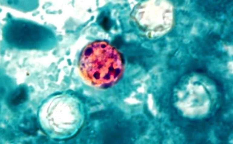 Cyclospora-cayetanensis.jpg