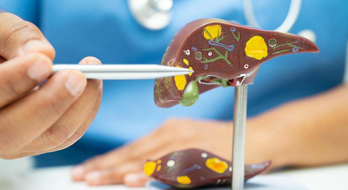 Enfermedad del hígado graso no alcohólico: 5 cosas que debes hacer todos los días para prevenirla