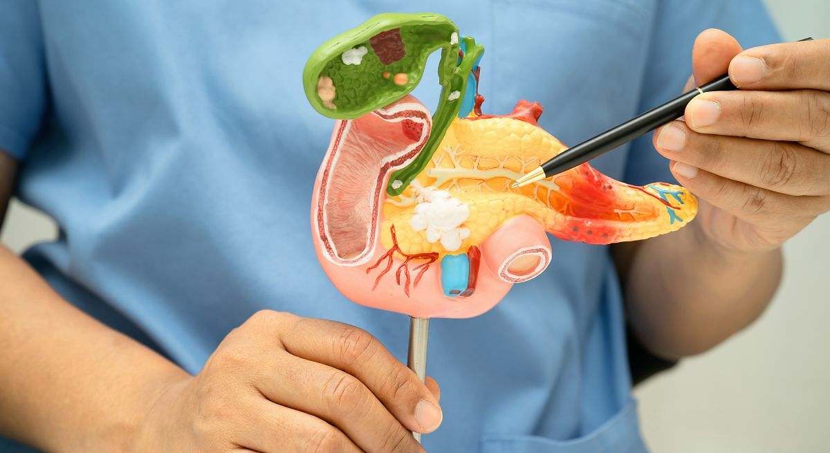 Revolución en el control del colesterol: su acumulación favorece el incremento de células tumorales en el cáncer de páncreas