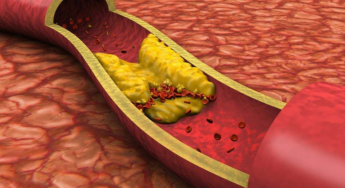 Una investigación demuestra que una inmunoterapia experimental logra revertir el daño energético del corazón causado por el colesterol