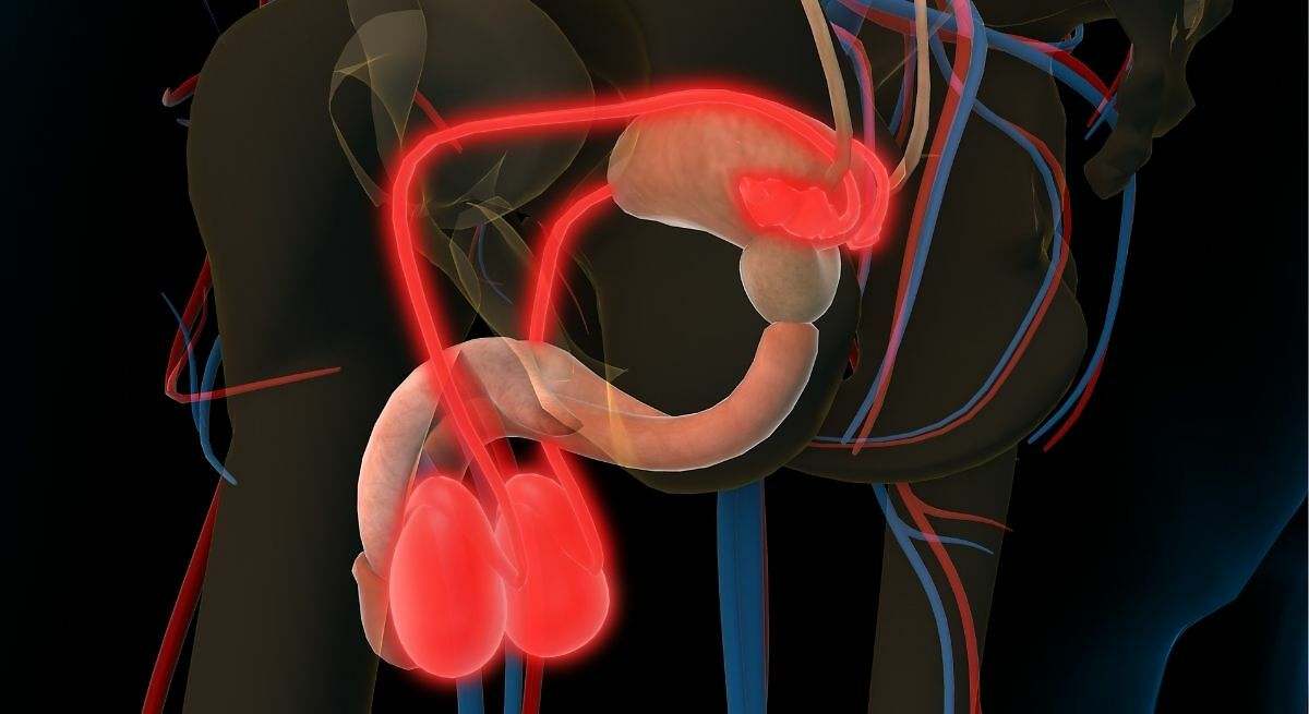 La vasovasostomía