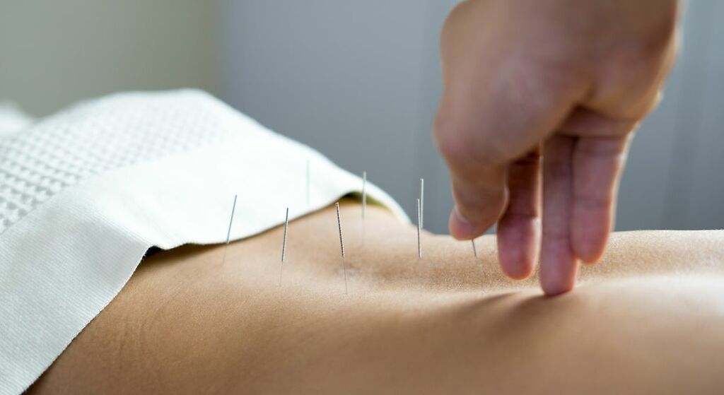 Acupuntura y terapias alternativas