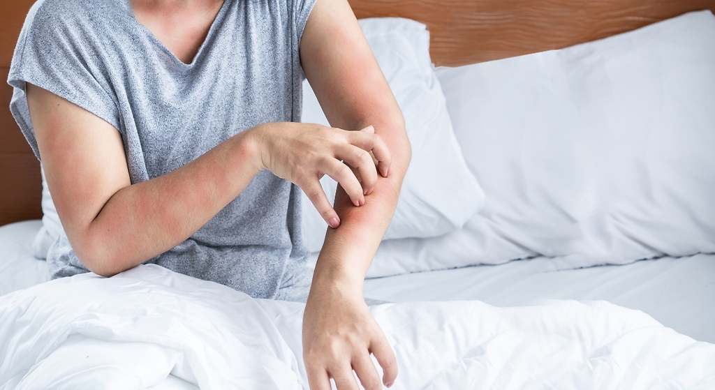 Sarpullidos y dermatitis