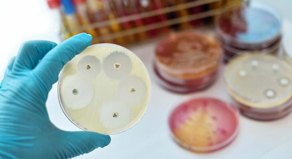 Efecto antimicrobiano y antiviral