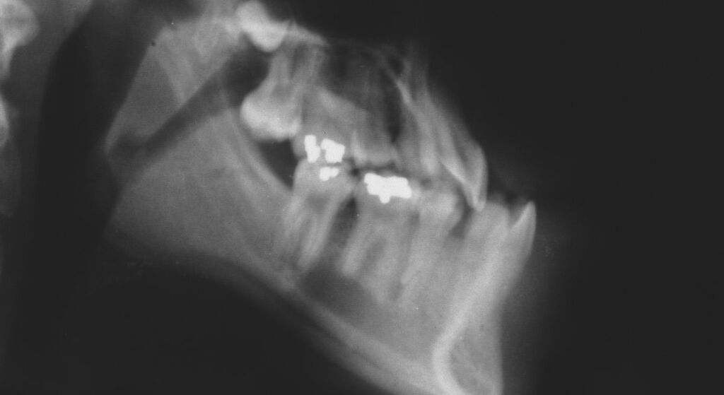 Fortifica los huesos y los dientes