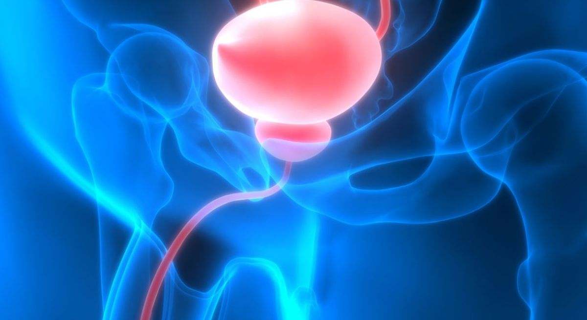 Lo que un oncólogo afirma sobre la forma de orinar para ayudar a detectar los primeros signos de cáncer de vejiga