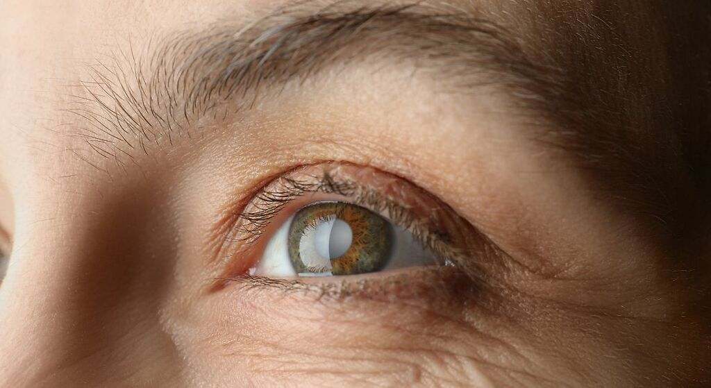 La vitamina que ayuda a prevenir las cataratas y el glaucoma, mejora la visión nocturna y retrasa la progresión de varias enfermedades oculares