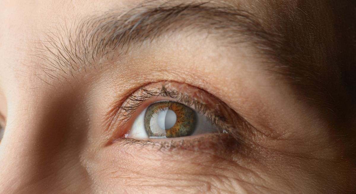 La vitamina que ayuda a prevenir las cataratas y el glaucoma, mejora la visión nocturna y retrasa la progresión de varias enfermedades oculares