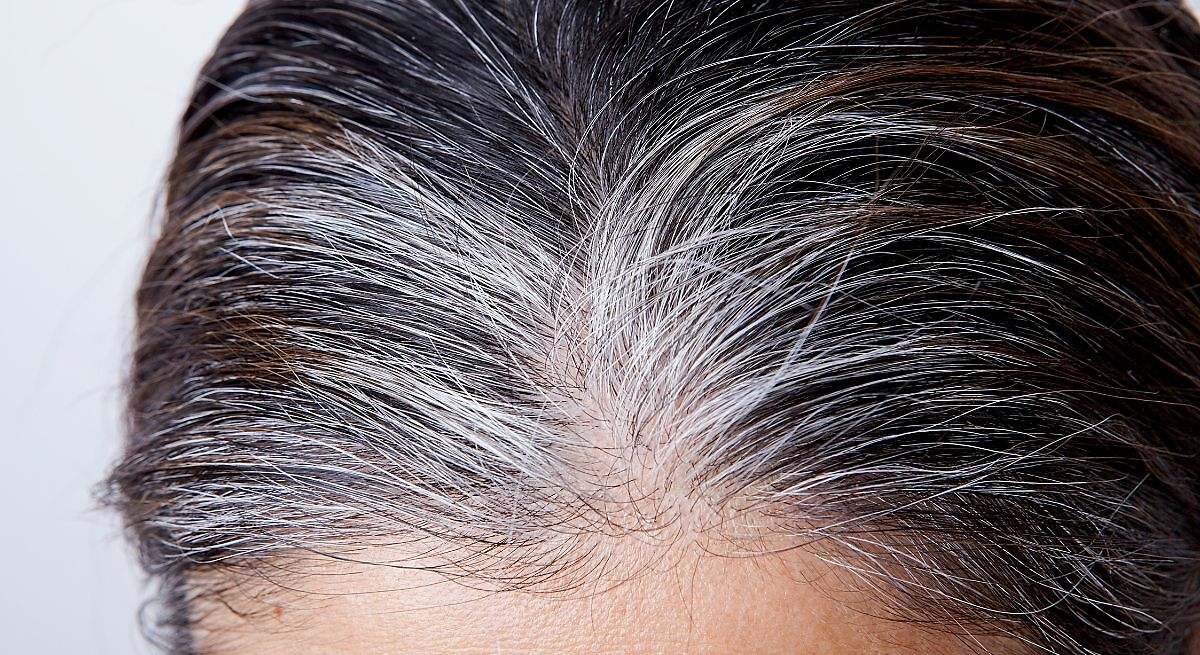 Por qué nos salen canas