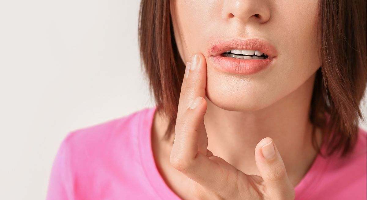 Ayuda a tratar el herpes labial