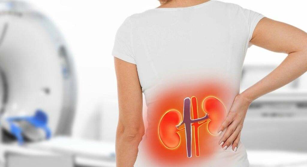 Daño renal: síntomas tempranos y silenciosos que indican que tus riñones no están funcionado correctamente