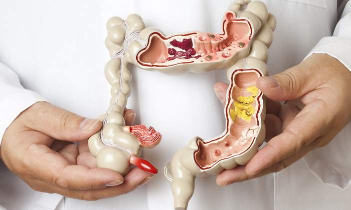 colon.jpg