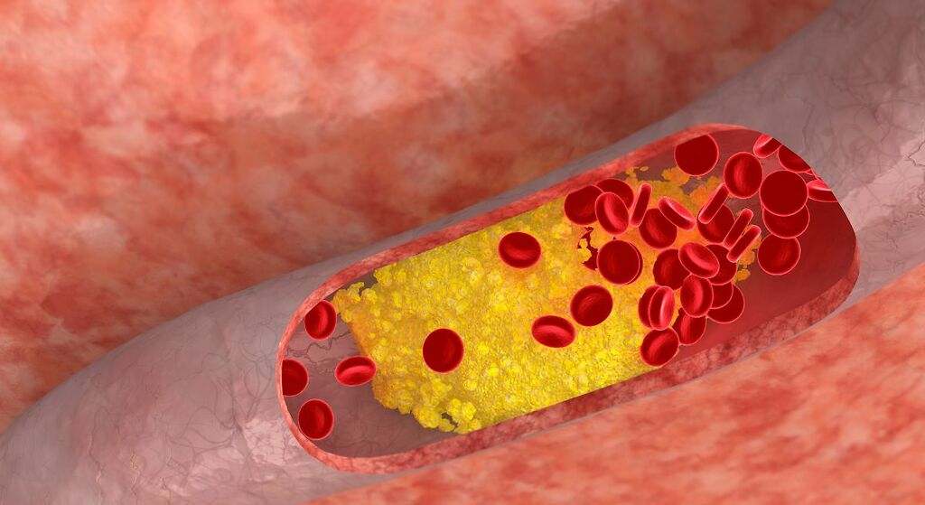 Reducción del colesterol