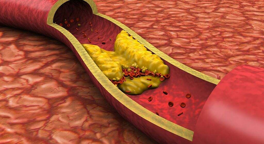Reduce el colesterol