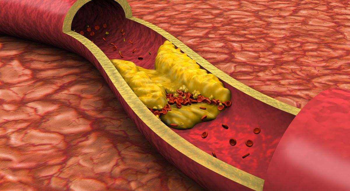 Qué hay que hacer para limpiar los dos pulmones: siete trucos sencillos para mantenerlos sanos