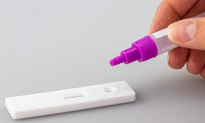 covid-test-antigenos-coronavirus-pixabay.jpg