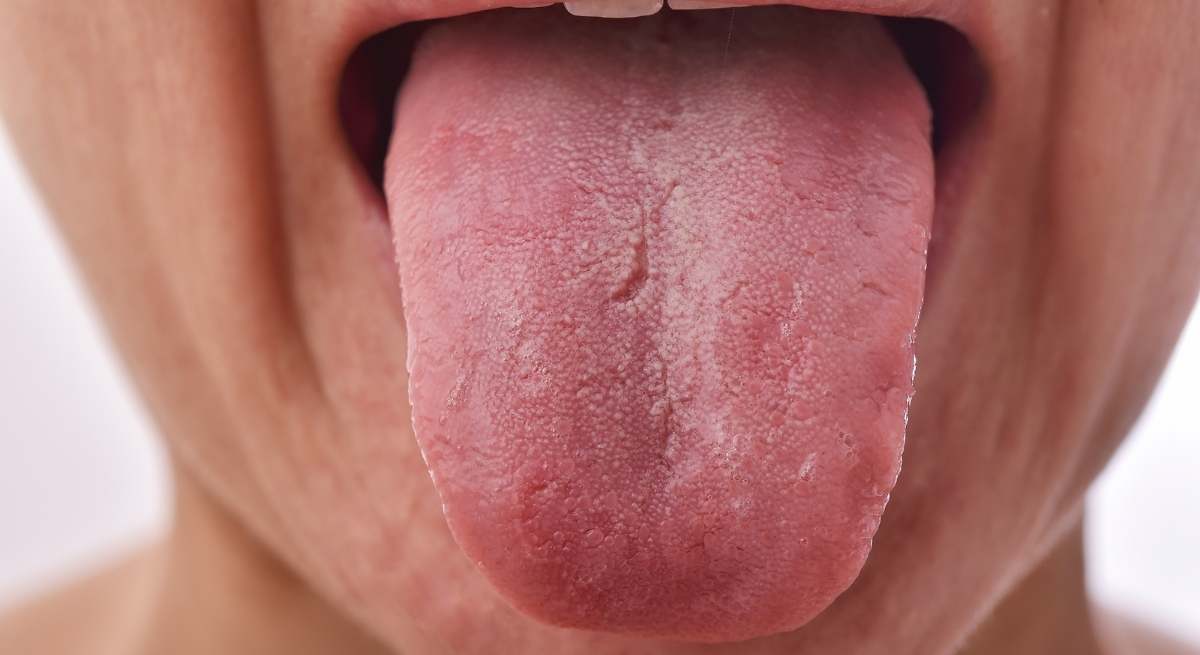 La lengua: zona importante