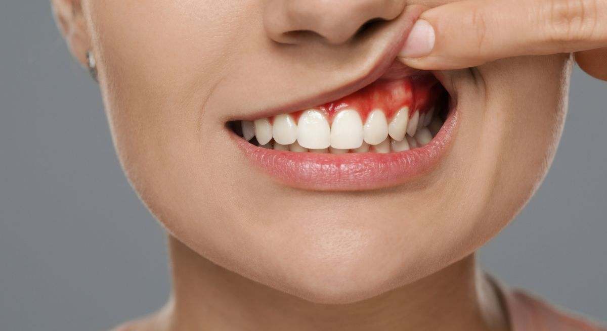 Combate la gingivitis y las infecciones bucales