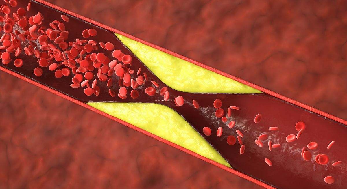 Reduce el colesterol LDL