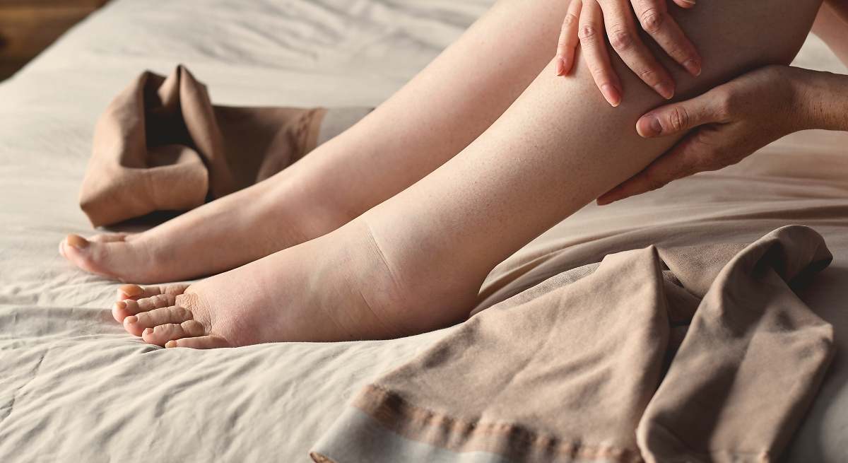 El truco de un doctor para acabar con las piernas y tobillos hinchados tras pasar muchas horas de pie, caminando o trabajando