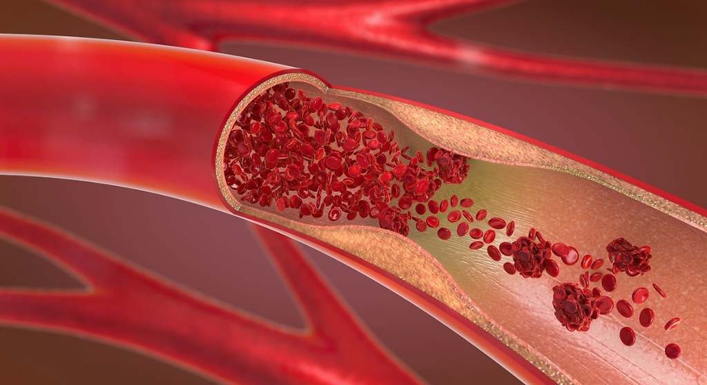 Arterias