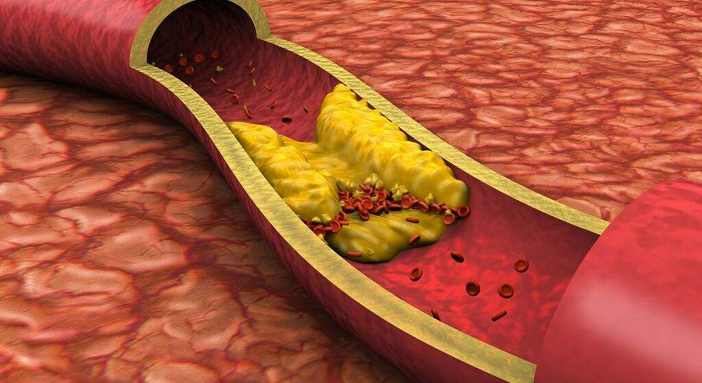 Ayuda a controlar los niveles de colesterol en la sangre