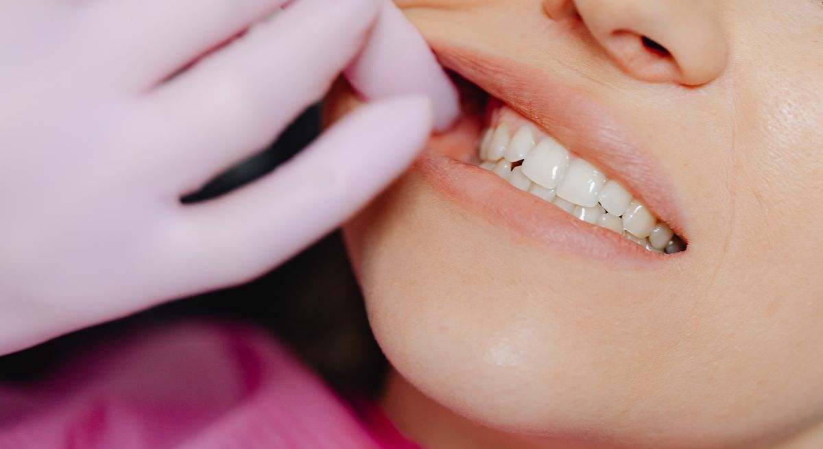 La revolucionaria técnica que ayuda a eliminar y prevenir el sarro de los dientes en cuestión de horas