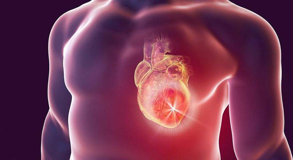 Enfermedades cardiovasculares