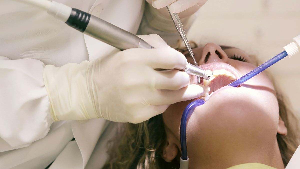 Previene el surgimiento de caries