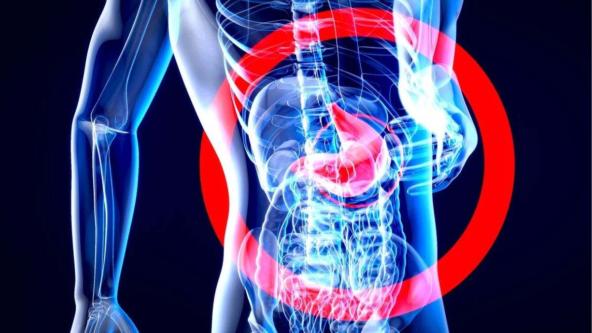 Mejora el sistema digestivo