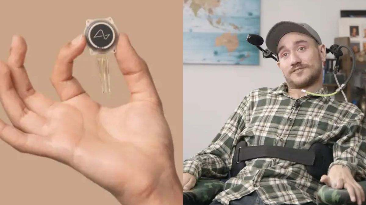 El hombre al que Musk implantó un chip en el cerebro muestra como está 18 meses después: "no debería ser posible..."