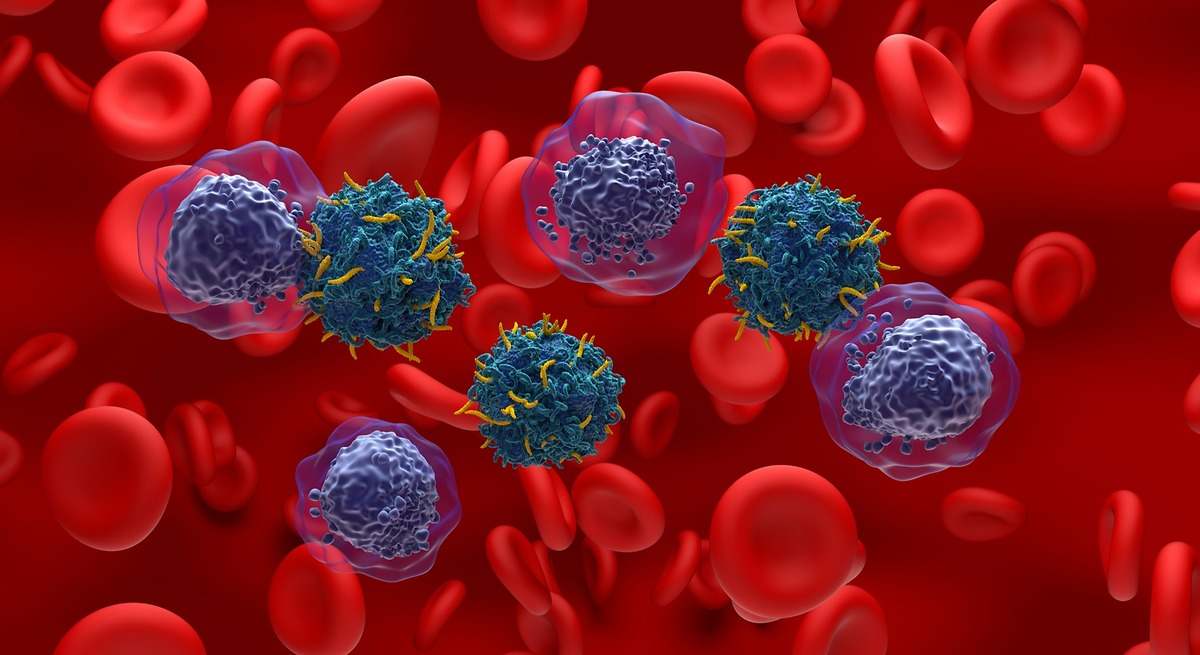 Un grupo de científicos de España ha creado un método  ultrasensible  para detectar un tipo de cáncer en la sangre