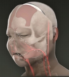 transplante_cara_vallhebron.jpg