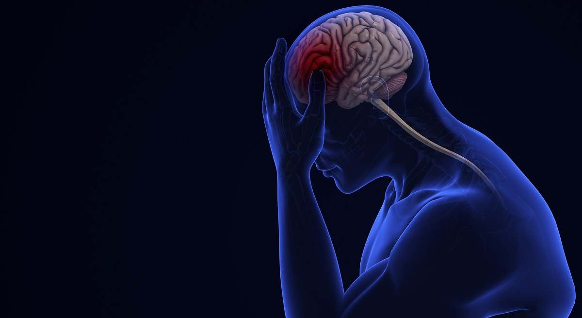 Qué es un ictus: causas, primeros síntomas y tratamiento