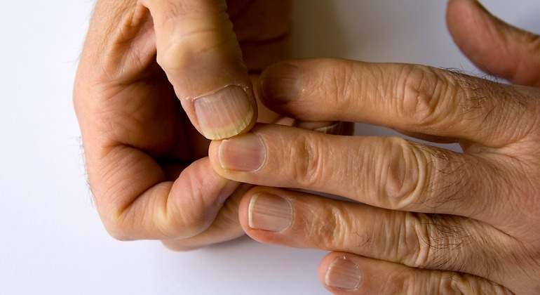 Manos mostrando las uñas