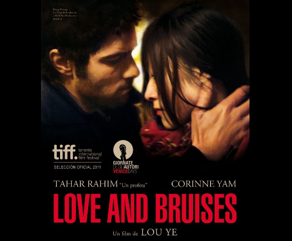 'Love and bruises'