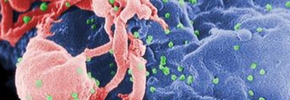 vih-wikipedia.jpg