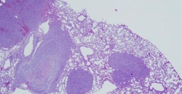 molecula-cancer-csic.jpg