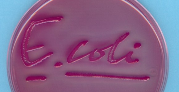 e-coli-2.jpg