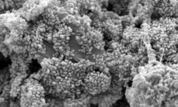 bacteria-superresistente-580x350.jpg