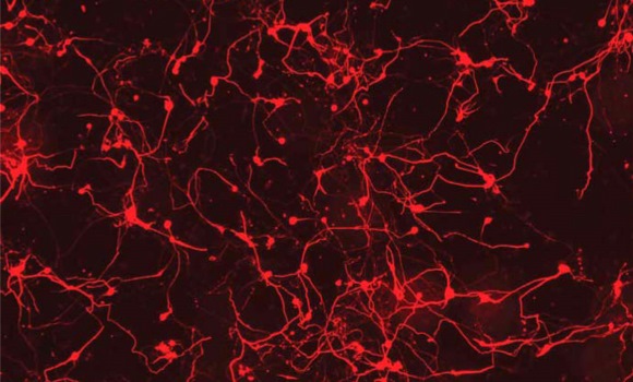 conexiones-neuronales-reuters.jpg